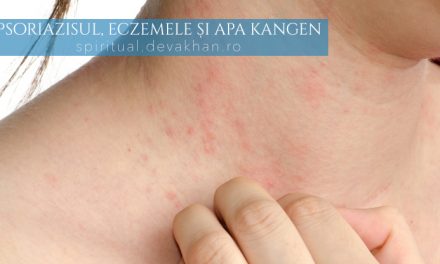 Psoriazis sau eczeme – prevenirea afecțiunilor cu apa Kangen
